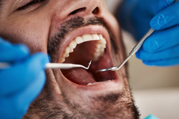Best Broken Tooth Emergency  in Forestde, AL